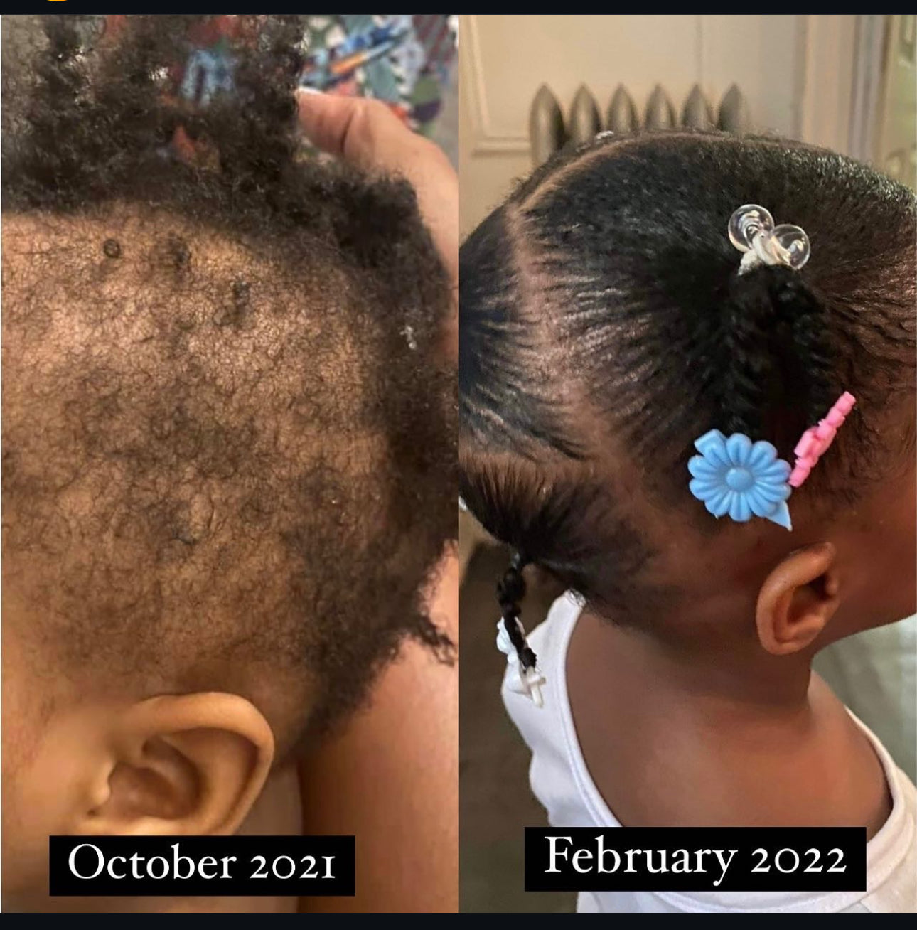 Hair Growth oil 2oz bottle